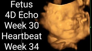胎児の心音 Fetus 4D Echo(Week 30) Heartbeat(Week 34)【Angel Sounds】