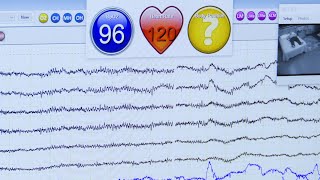 Sleep Study