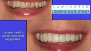 Dr. John Kacher, DDS