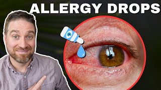 Best Allergy Eye Drops For Red Itchy Eyes! (2025)