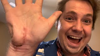 2 Weeks AFTER Surgery! - Ulnar Neuropathy Guyon’s Canal Surgery (Part 6)