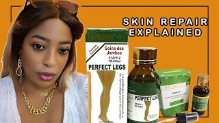 Bel Eclat Kenacol l Scenic Perfect Legs Stage 2 Review l How to Use Them Properly for Skin Repair