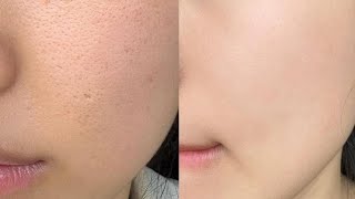 experimental textureless baby skin ⋅˚ ୨୧ deep exfoliation.