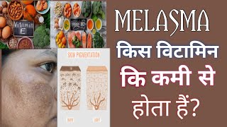 MELASMA किस विटामिन कि कमी से होता हैं? झाइयां क्यों ठीक नहीं हो रही हैं?