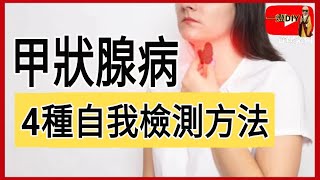 你有甲狀腺失調嗎？動動手4招自我檢測甲亢 甲減！超簡單實用
