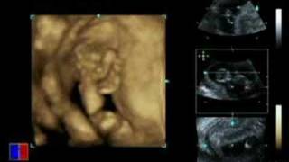 My new Grandbaby