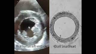 4Dcell - Comparison between real human left ventricle and 4Dcell cardiac organoid SmartHeart