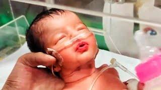 Preterm Baby on Oxygen with Poor Sucking Reflex.