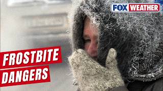 Doctor Details Dangers Of Frostbite As Extreme Cold From Arctic Air, Polar Vortex Threatens Millions