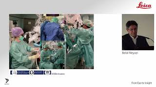 First clinical results: Exoscopic vs. microsurgical procedures