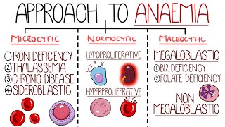 Anaemia Made Easy (An Approach to Anaemia)