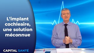 L'implant cochléaire , une solution méconnue - Capital Santé
