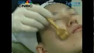 Does Derma roller really work? What is derma roller?