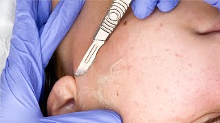 Satisfying Dermaplaning with ASMR sounds