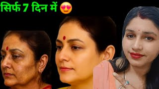  घर में शादी 9 साल पुरानी झाइयां, सिर्फ इस 👆 से चली गई, बस ये अपनाले #realbeautyvlog #skincare 