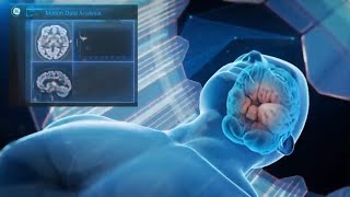 Motion Management for SIGNA PET/MR | GE Healthcare