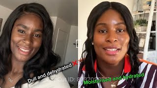 Best body Product and ingredient that gives you glowing skin. #skincare #glowingskin  #bodycare 