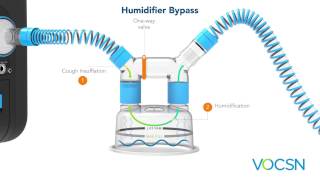 Ventec Humidifier Bypass & Touch Button Cough™