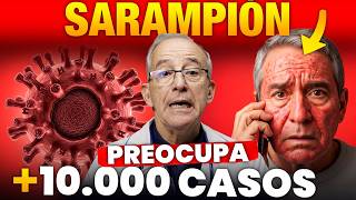 ☄️ SARAMPION En Mexico: Por Qué Es Tan Preocupante (Síntomas y Haz Esto) - Oswaldo Restrepo RSC