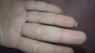 reassuring you and massaging your head while you're sick ASMR