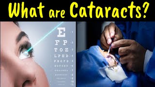 Eye Cataracts | Signs, Symptoms, Treatment & Prevention