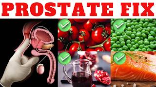 Prostate Friendly foods