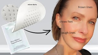 How to GET RID of WRINKLES ?!! Qure Targeted Infusion Micro Patches Review! (AD)