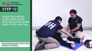 Open Straight Knee Fracture Double Lateral