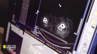 Scientists figure out how mummies use to sound