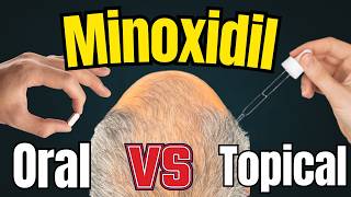 Is Oral Minoxidil REALLY Better Than Topical For Hair Loss? New Clinical Trial Results