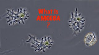 What is Amoeba?