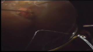 The Unexpected Diagnosis by Aslan Aykut, Ozlem Sahin, Turkey mp4