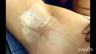 Teenage Girl Armpit Waxing || Under Arm Waxing Teenage Girl