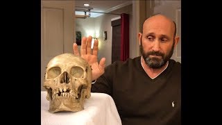 Dr. Lanny - TMJ "INTENSE" Karate adjustment to the Jaw - Massage + Chiro