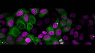 Live cell imaging