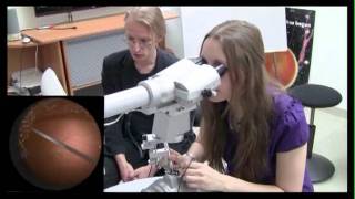 completePPVinEyesi KOCH.mov