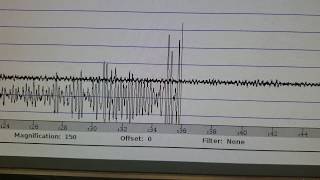 M7.7 Cuba/Jamaica Earthquake - Seismic waves reach San Diego