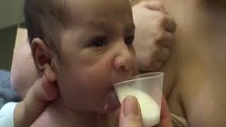 Dr  Jack Newman   Cup Feeding