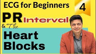 ECG for Beginners. जानिये PR interval, PR segment और Heart Blocks-1st,2nd and 3rd Degree के बारे में