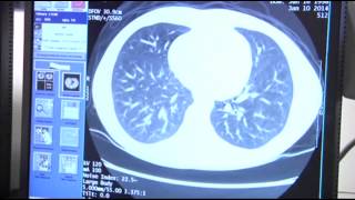 Radiation ID Cards to Monitor Child's Exposure