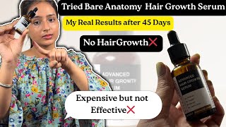 Bare Anatomy Advanced Hair Growth Serum Review After 45 Days | Honest Results & Experience