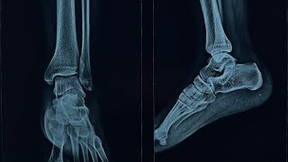 El Salvador Pt.28 | X-Rays