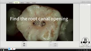 ADAE Endodontic micro camera-Quick view