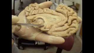 Brain Anatomy