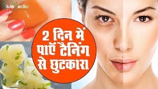 गर्मियों के मौसम में टैनिंग को हटाकर लाये एक अद्भुत निखार | DIY Homemade Tan Remover