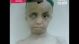 100 Ways Aid Works - #98