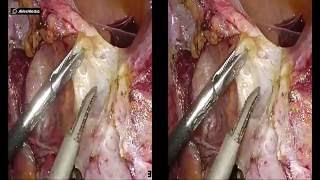 Dr Modi's 3D TLH July 2016