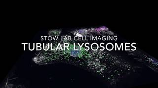 Tubular Lysosomes: Stow Lab Cell Imaging