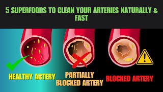 Eat These 5 Foods to Support Artery Health – Based on Scientific Studies