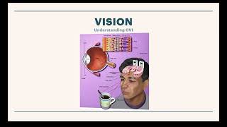 CViConnect – Identifiying CVI